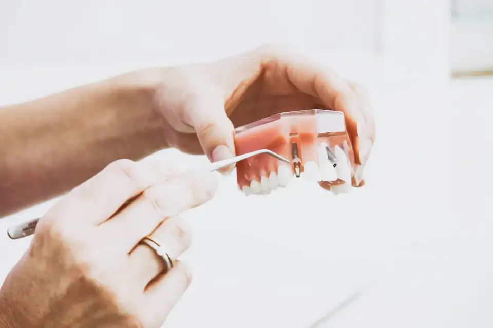 The right tooth shape